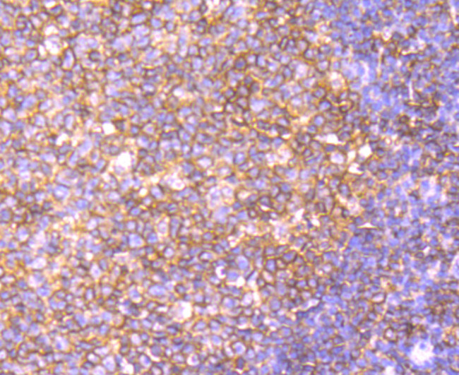 B7-H4 Antibody in Immunohistochemistry (Paraffin) (IHC (P))