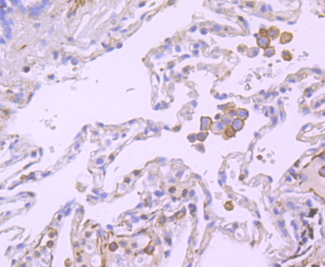 B7-H4 Antibody in Immunohistochemistry (Paraffin) (IHC (P))