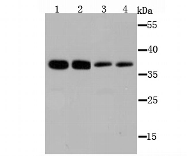 B7-H4 Antibody in Western Blot (WB)