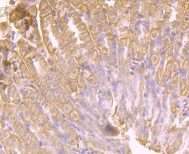 AKR1C1 Antibody in Immunohistochemistry (Paraffin) (IHC (P))