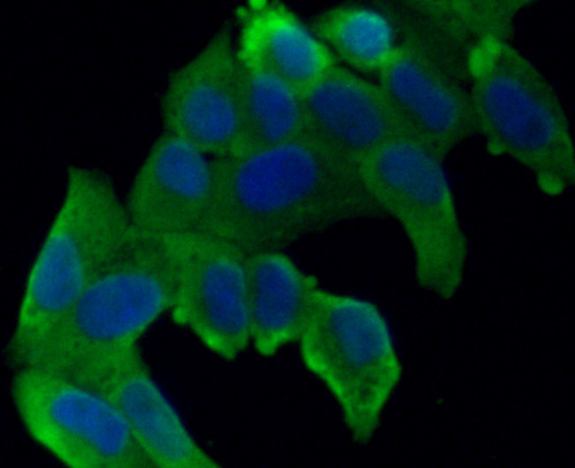 VCAM-1 (CD106) Antibody in Immunocytochemistry (ICC/IF)