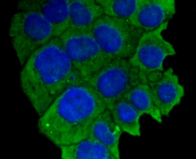 VCAM-1 (CD106) Antibody in Immunocytochemistry (ICC/IF)