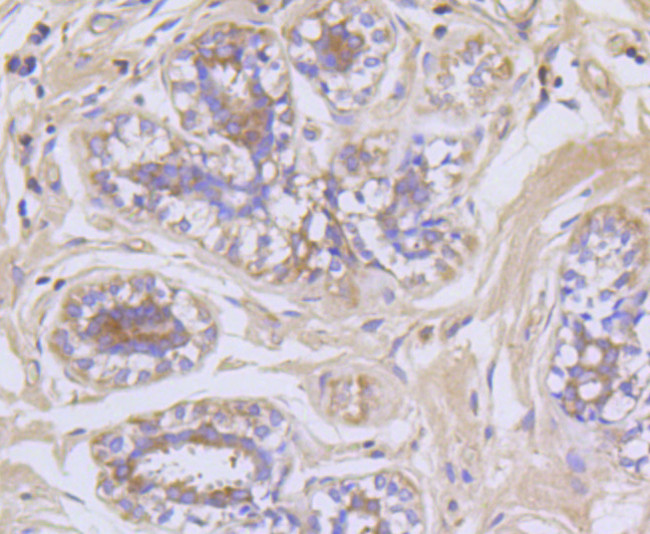 Glypican 1 Antibody in Immunohistochemistry (Paraffin) (IHC (P))