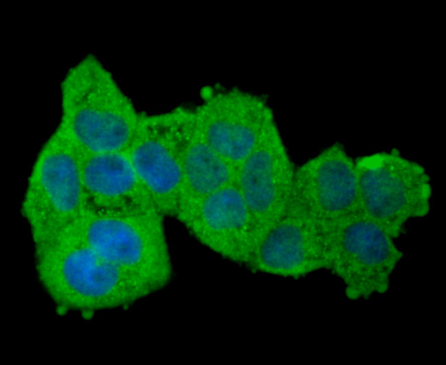 Aconitase 1 Antibody in Immunocytochemistry (ICC/IF)