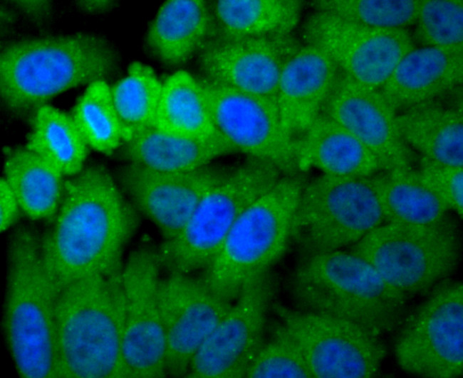 Aconitase 1 Antibody in Immunocytochemistry (ICC/IF)