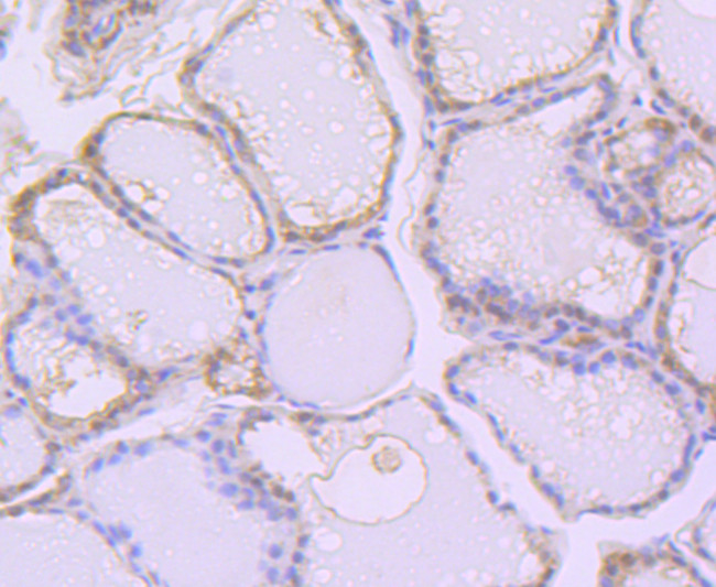 Aconitase 1 Antibody in Immunohistochemistry (Paraffin) (IHC (P))