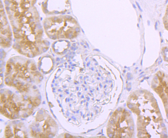 Aconitase 1 Antibody in Immunohistochemistry (Paraffin) (IHC (P))