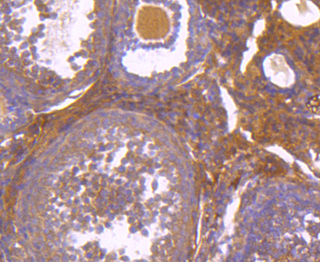 Aconitase 1 Antibody in Immunohistochemistry (Paraffin) (IHC (P))