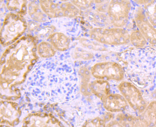 Aconitase 1 Antibody in Immunohistochemistry (Paraffin) (IHC (P))