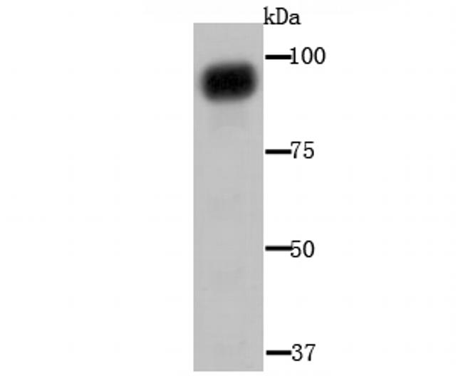 Aconitase 1 Antibody in Western Blot (WB)