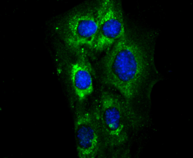 MYL2 Antibody in Immunocytochemistry (ICC/IF)