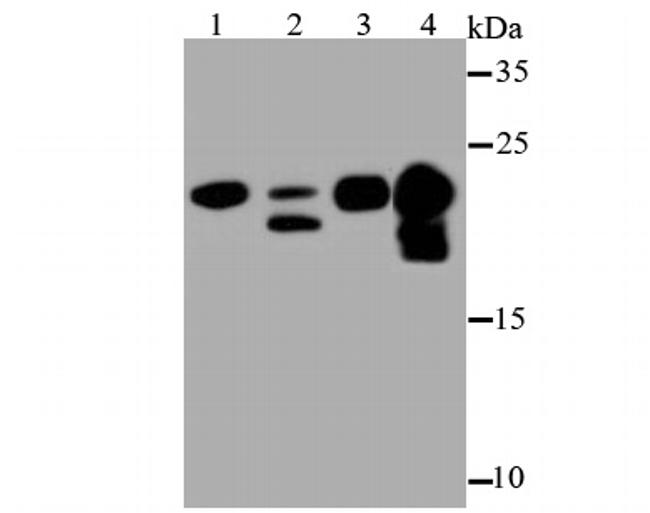 MYL2 Antibody in Western Blot (WB)