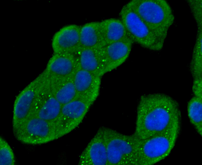 Cathepsin D Antibody in Immunocytochemistry (ICC/IF)