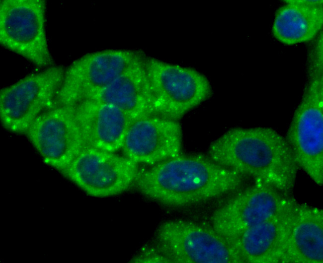 Cathepsin D Antibody in Immunocytochemistry (ICC/IF)