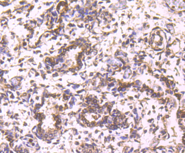 Cathepsin D Antibody in Immunohistochemistry (Paraffin) (IHC (P))