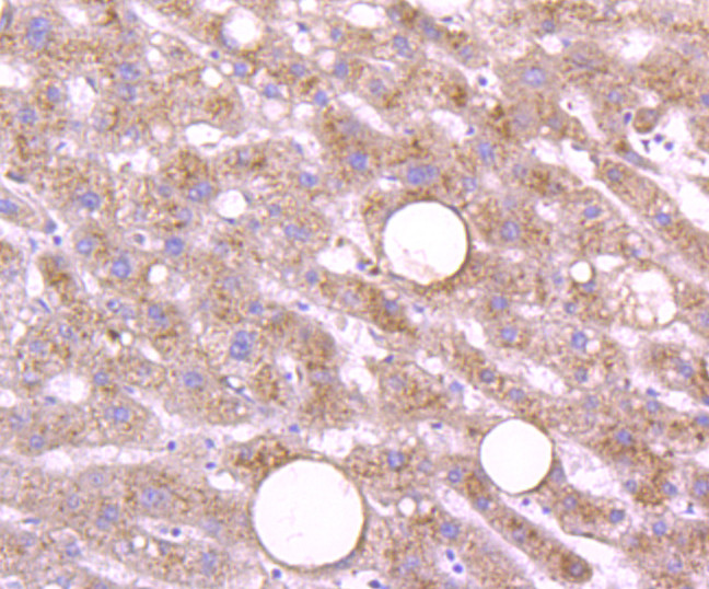 Cathepsin D Antibody in Immunohistochemistry (Paraffin) (IHC (P))