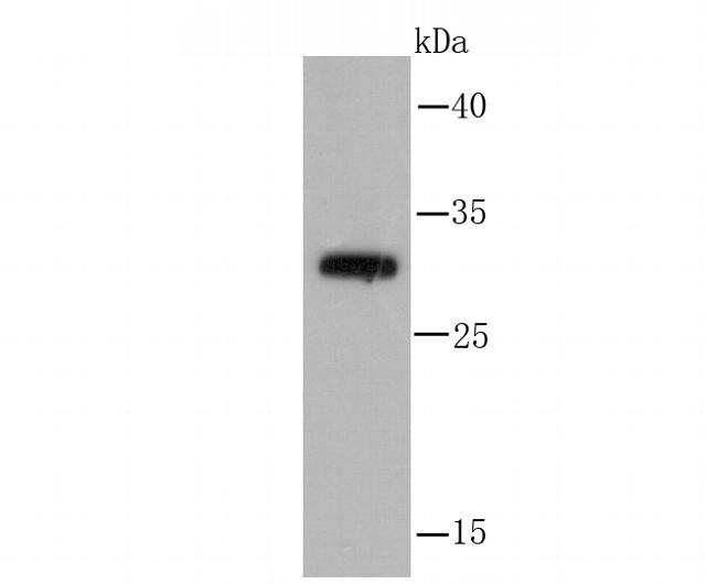 Cathepsin D Antibody in Western Blot (WB)