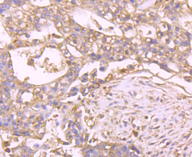 Filamin A Antibody in Immunohistochemistry (Paraffin) (IHC (P))