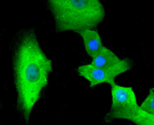 ASS1 Antibody in Immunocytochemistry (ICC/IF)