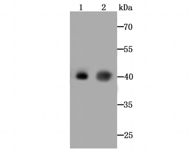 ASS1 Antibody in Western Blot (WB)