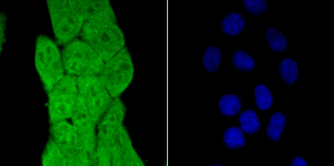 PCBP1 Antibody in Immunocytochemistry (ICC/IF)