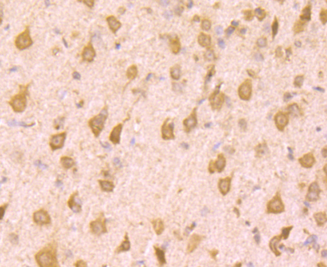 PCBP1 Antibody in Immunohistochemistry (Paraffin) (IHC (P))