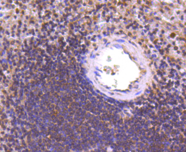 PCBP1 Antibody in Immunohistochemistry (Paraffin) (IHC (P))