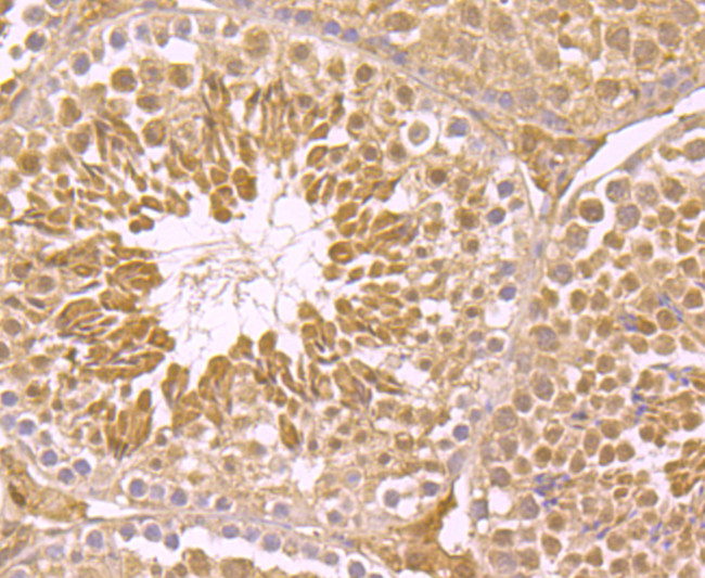 PCBP1 Antibody in Immunohistochemistry (Paraffin) (IHC (P))