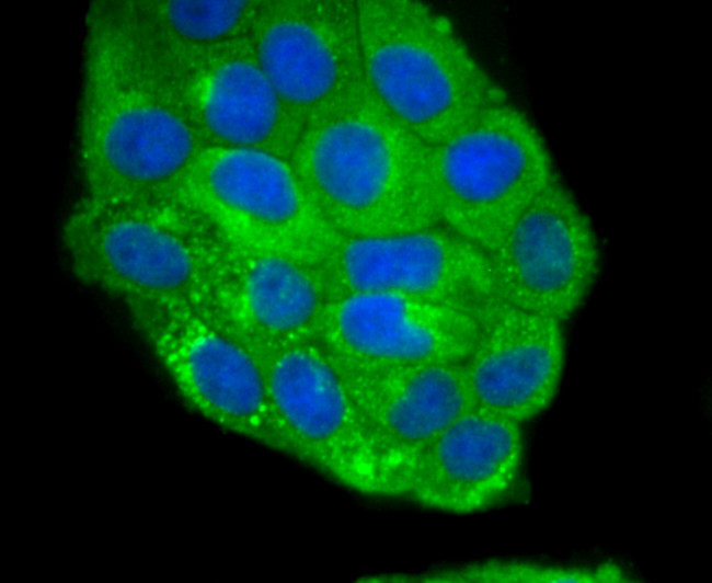 Jagged1 Antibody in Immunocytochemistry (ICC/IF)