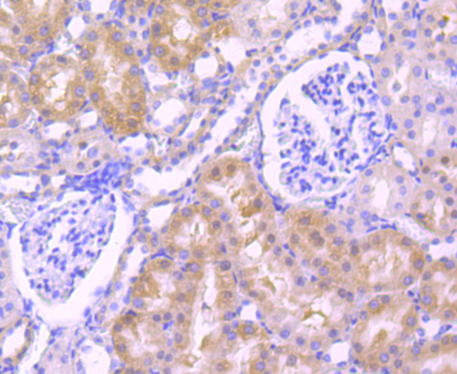 Jagged1 Antibody in Immunohistochemistry (Paraffin) (IHC (P))