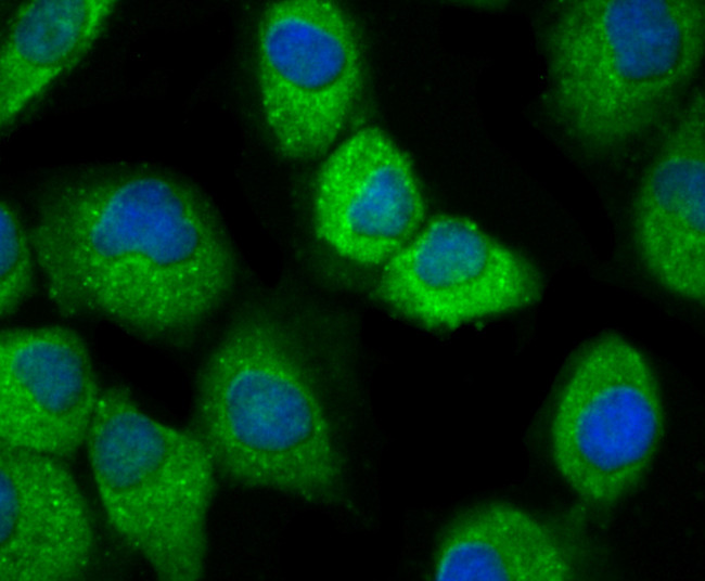 IKK beta Antibody in Immunocytochemistry (ICC/IF)