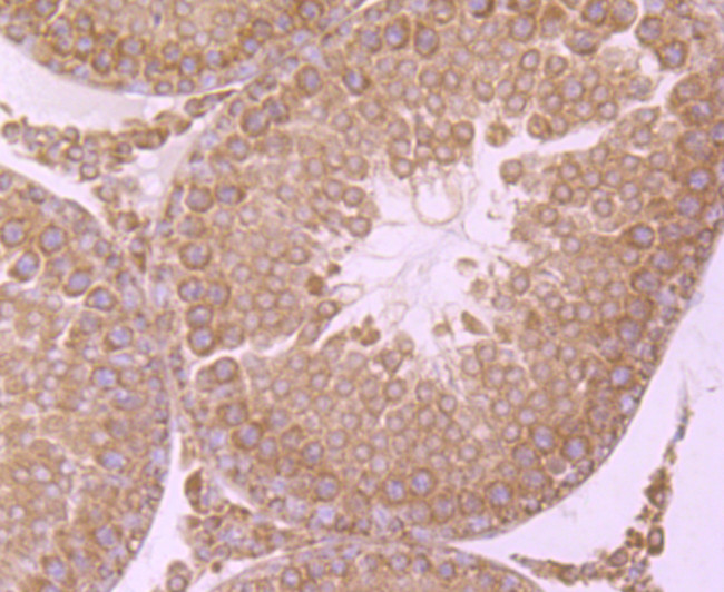 IKK beta Antibody in Immunohistochemistry (Paraffin) (IHC (P))