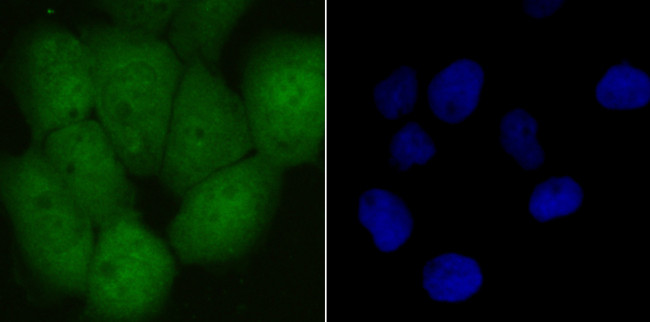 UBA3 Antibody in Immunocytochemistry (ICC/IF)