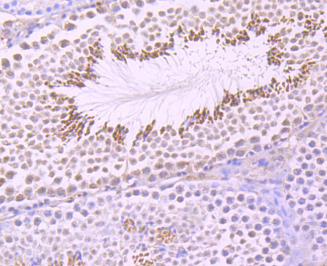 UBA3 Antibody in Immunohistochemistry (Paraffin) (IHC (P))