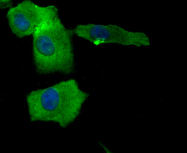 Bax Antibody in Immunocytochemistry (ICC/IF)