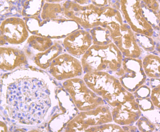 Bax Antibody in Immunohistochemistry (Paraffin) (IHC (P))