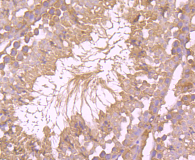 Bax Antibody in Immunohistochemistry (Paraffin) (IHC (P))