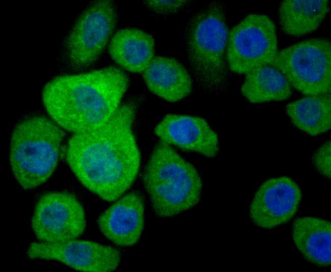 S100A8 Antibody in Immunocytochemistry (ICC/IF)