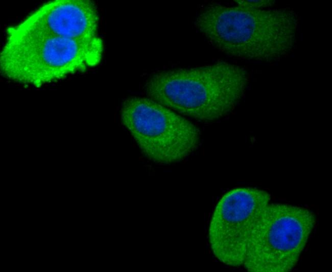 S100A8 Antibody in Immunocytochemistry (ICC/IF)