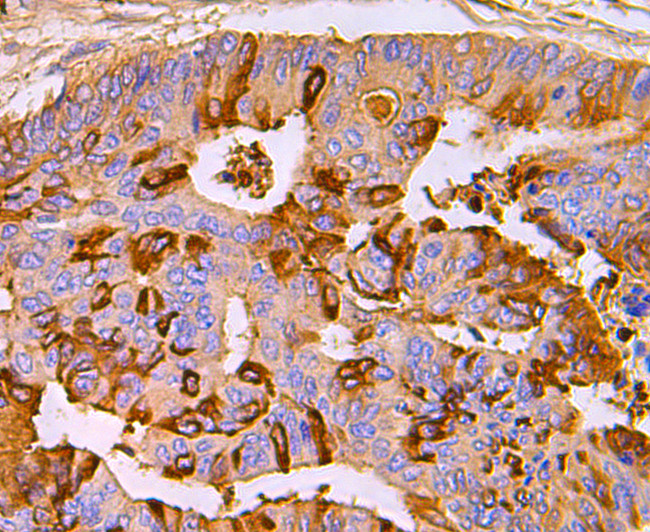 S100A8 Antibody in Immunohistochemistry (Paraffin) (IHC (P))