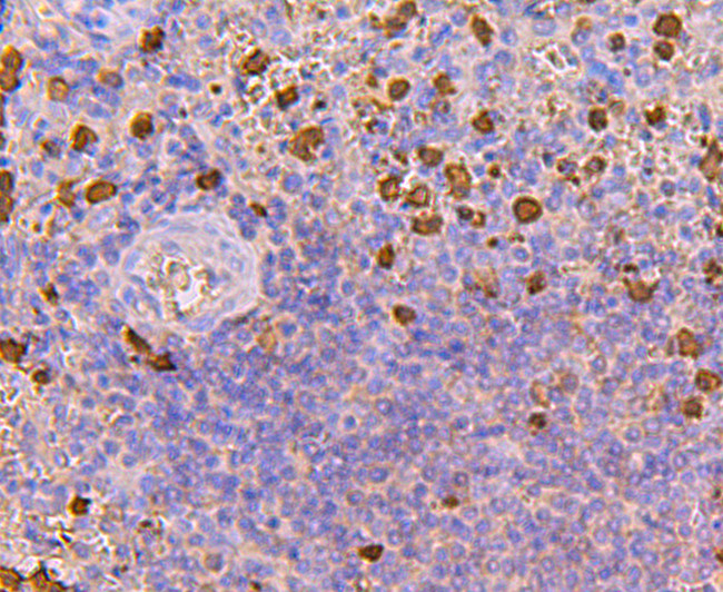 S100A8 Antibody in Immunohistochemistry (Paraffin) (IHC (P))