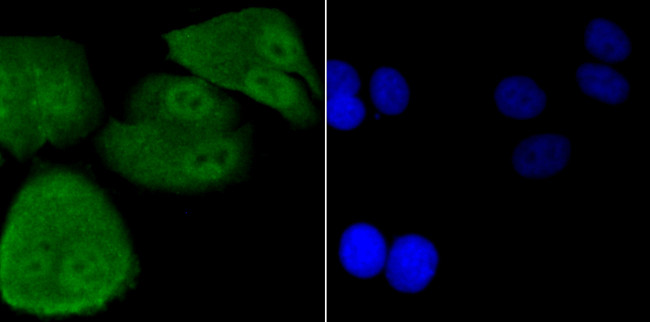 DDB1 Antibody in Immunocytochemistry (ICC/IF)