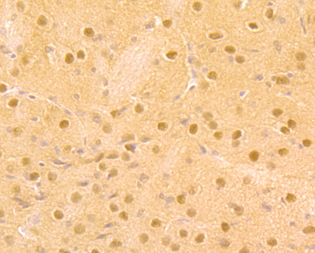 DDB1 Antibody in Immunohistochemistry (Paraffin) (IHC (P))