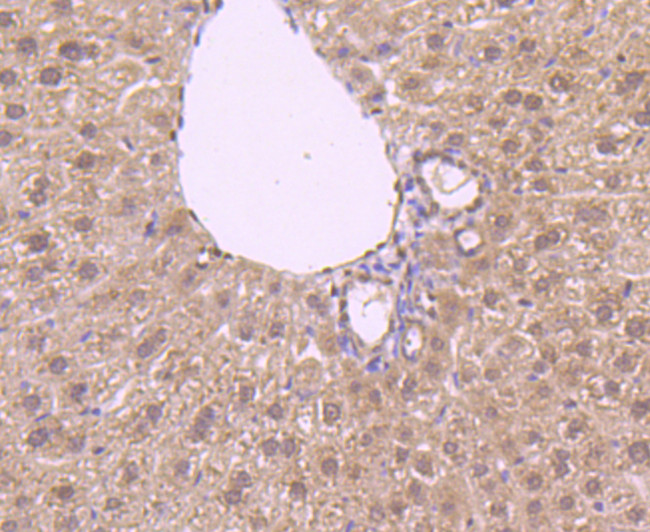 NFIB Antibody in Immunohistochemistry (Paraffin) (IHC (P))