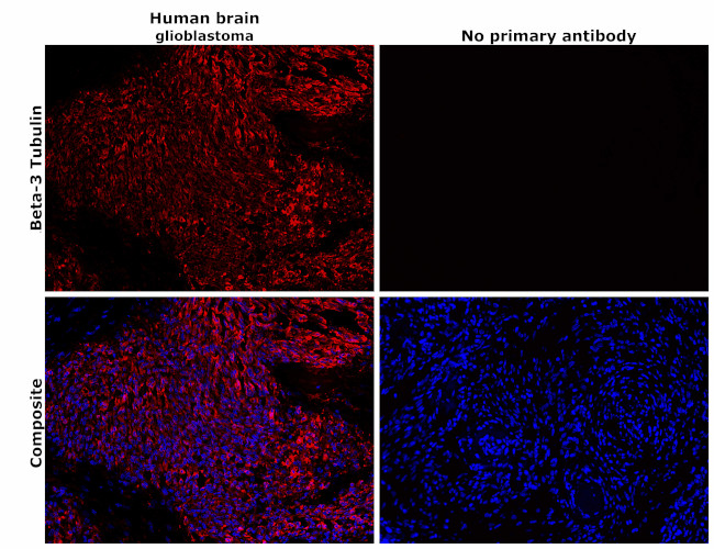 beta-3 Tubulin Antibody in Immunohistochemistry (Paraffin) (IHC (P))