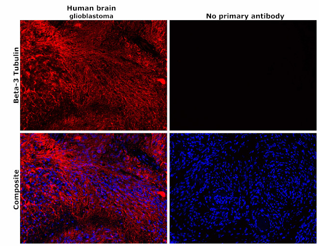 beta-3 Tubulin Antibody in Immunohistochemistry (Paraffin) (IHC (P))