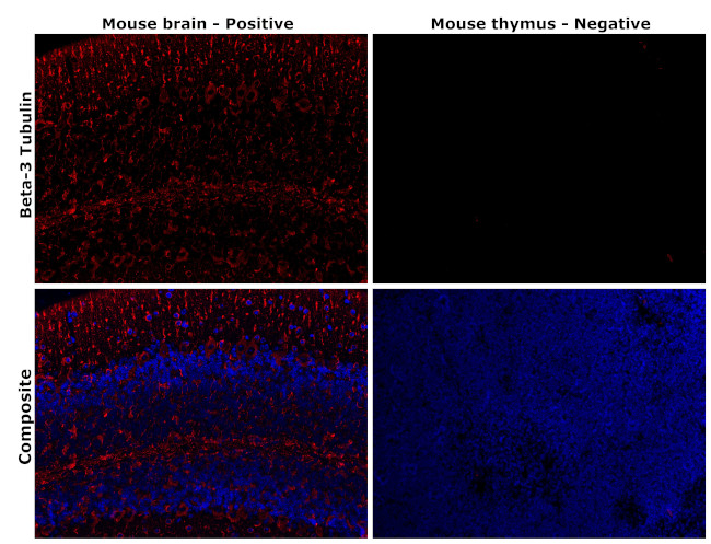 beta-3 Tubulin Antibody in Immunohistochemistry (Paraffin) (IHC (P))