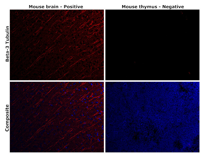 beta-3 Tubulin Antibody in Immunohistochemistry (Paraffin) (IHC (P))