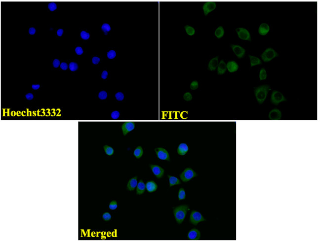 beta-3 Tubulin Antibody in Immunocytochemistry (ICC/IF)