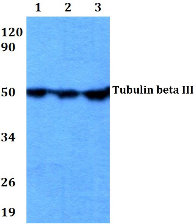 beta-3 Tubulin Antibody in Western Blot (WB)